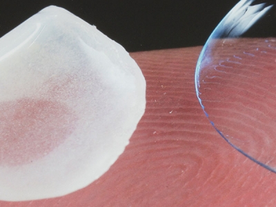 LENTES DE CONTATO EM ODONTOLOGIA